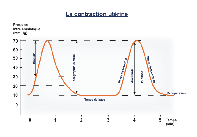 La contraction utérine ne se fait pas de manière constante mais passer par des phases de ascendantes et descendantes d'intensités différentes.
