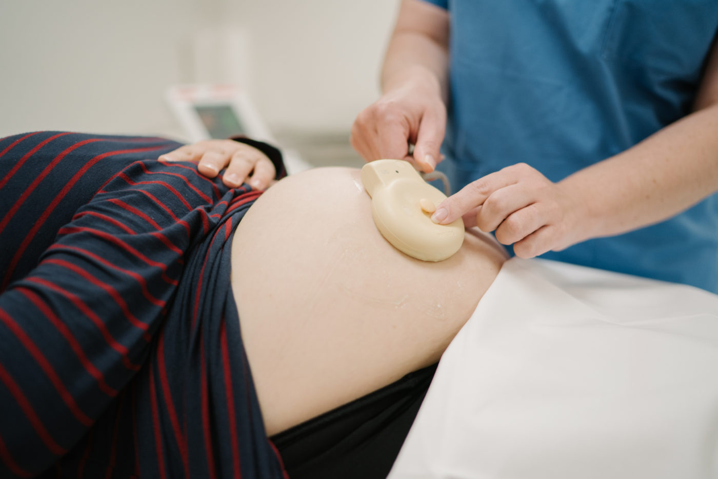Accouchement : à quoi sert le monitoring fœtal ?