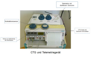 Das CTG- und Telemetriegerät ist ein Kontraktorsensor, der mit oder ohne Kabel funktioniert. Es kann auch den Herzrhythmus mithilfe von Sensoren aufzeichnen.
