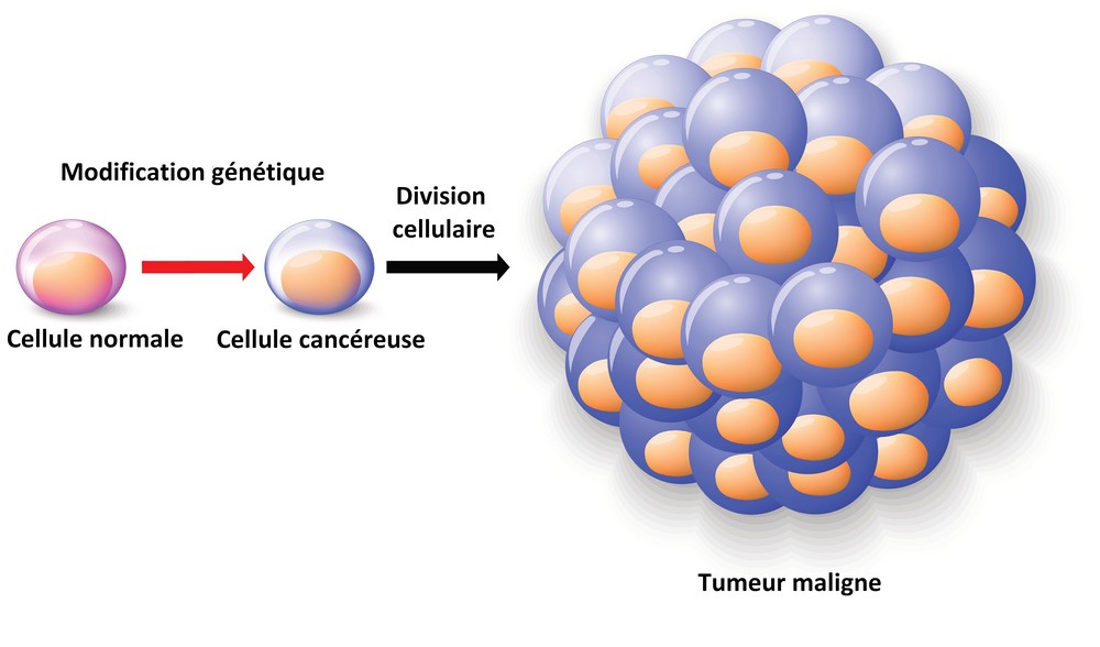 cancer cellule maligne papilloma virus cure alternative