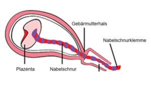Diese Abbildung zeigt die Plazenta, die Nabelschnur, den Gebärmutterhals und die Vagina.