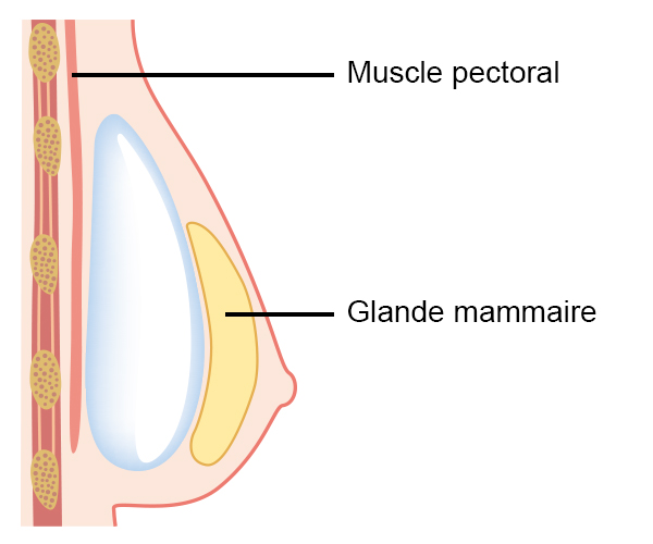 Le muscle pectoral se trouve derrière la glande mammaire