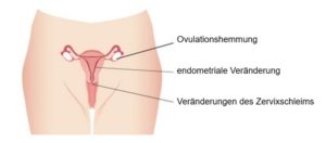 Hemmung des Eisprungs, Veränderung des Endometriums und Veränderung des Zervixschleims