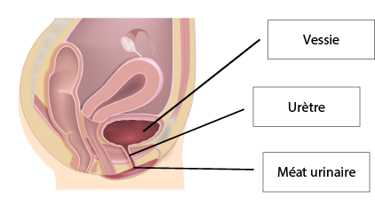 Incontinence urinaire : causes et traitements - Conseils santé