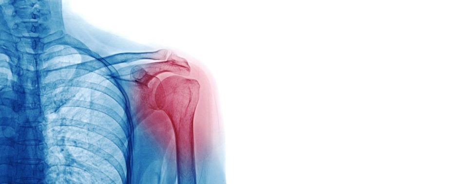 HopitalKirchberg_Osteoporose_Os