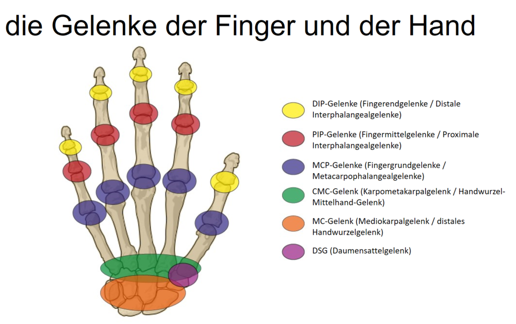 Rheumatoide Arthritis Die Diagnose