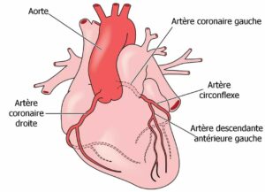 De l'aorte principale partent l'artère coronaire droite (partie inférieure), l'artère descendante antérieure gauche (partie inférieure), l'artère circonflexe et l'artère coronaire gauche.