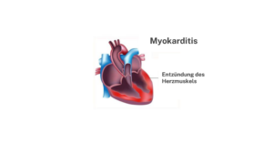 Bei einer Myokarditis handelt es sich um eine Entzündung des Herzmuskels.