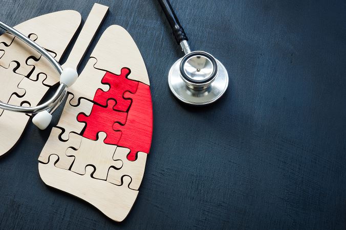 Vue en plongée d’une maquette de poumons en puzzle en bois avec une pièce rouge représentant une zone pathologique, accompagnée d’un stéthoscope posé sur une surface noire.